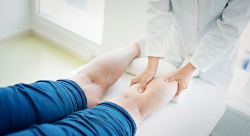 Варикоз нижних конечностей: симптомы и лечение